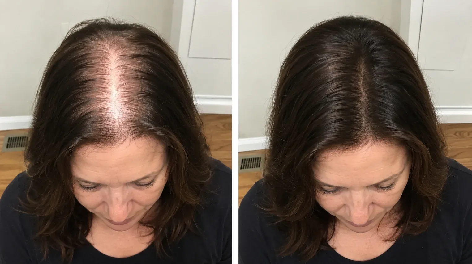 Before and after: her part, 3 months apart