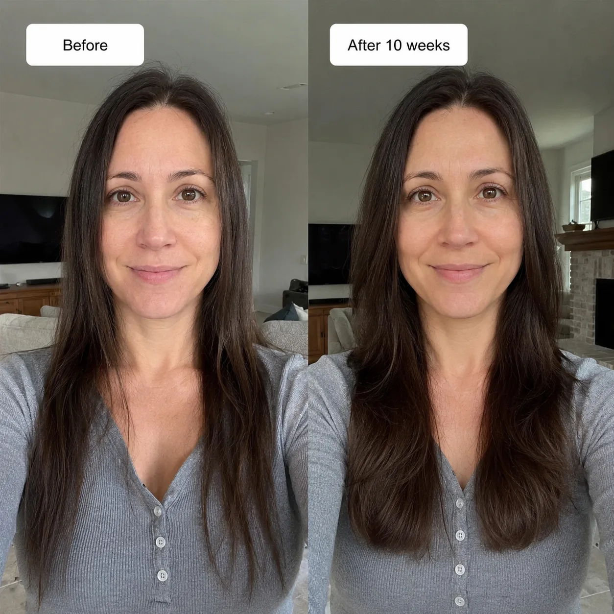 Gail M. before and after placeholder