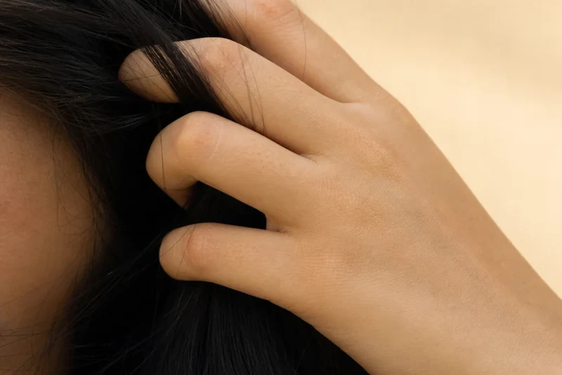 Why Hair Is the Last Thing to Come Back