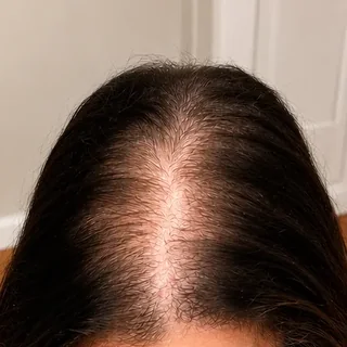 Hair result