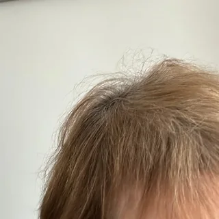 Hair result