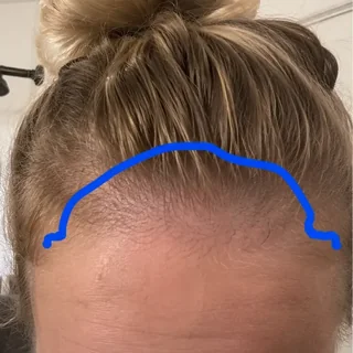 Hair result