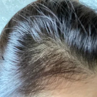 Hair result
