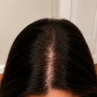 Hair result
