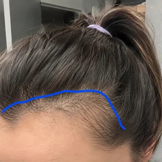 Hair result