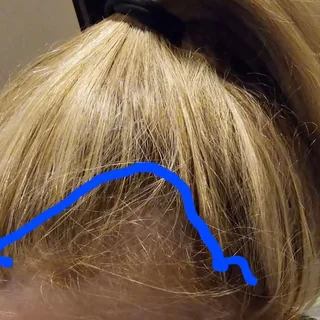 Hair result