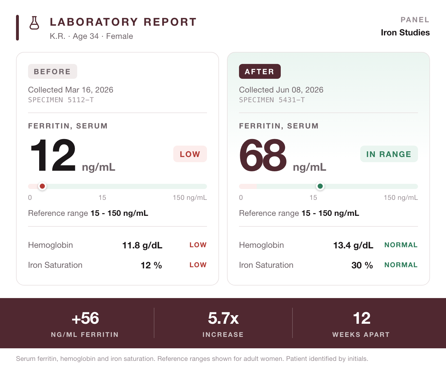 Laboratory report showing serum ferritin 12 ng/mL flagged low and 68 ng/mL in range