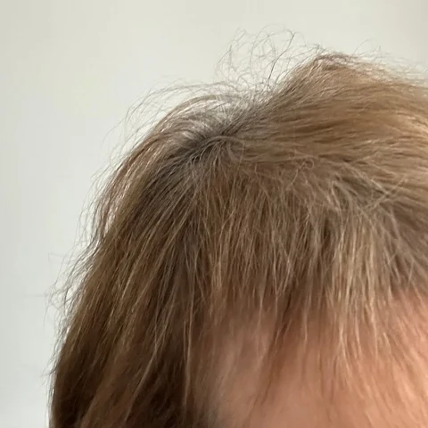Hair result