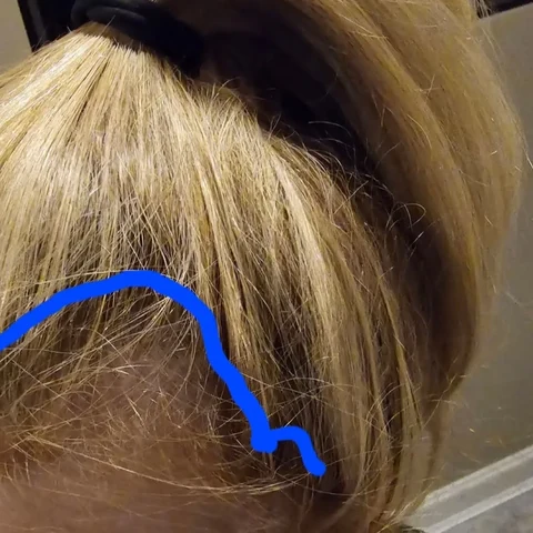 Hair result