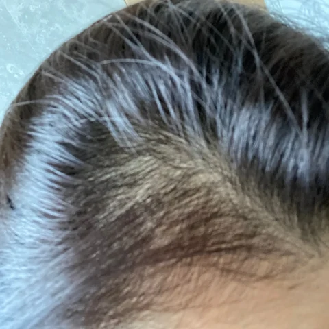 Hair result