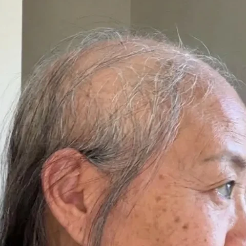 Hair result