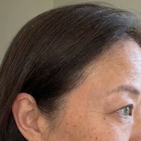 Hair result