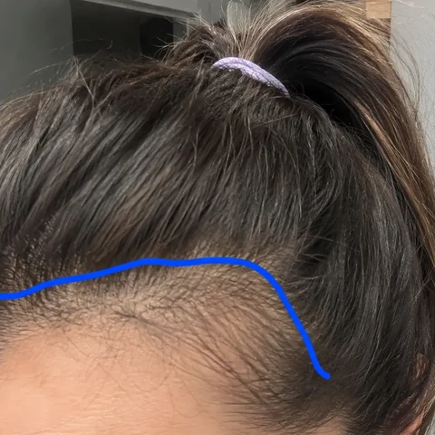 Hair result