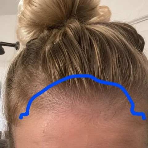 Hair result