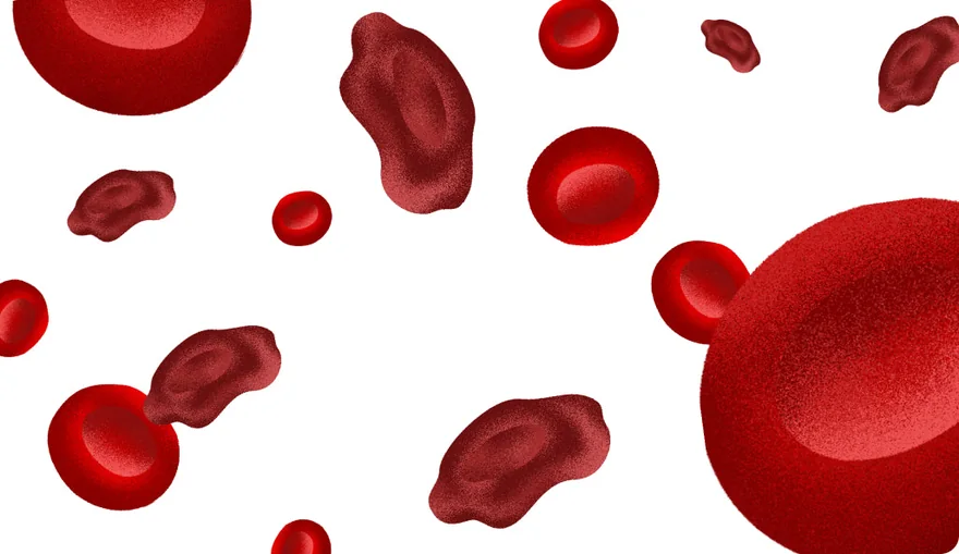 Illustration of misshapen and broken red blood cells