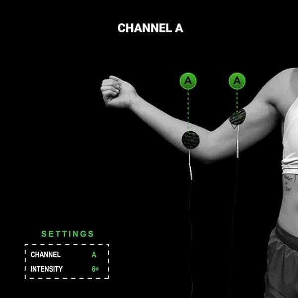 Channel A placement, one pad on the forearm and one on the bicep, intensity six or higher