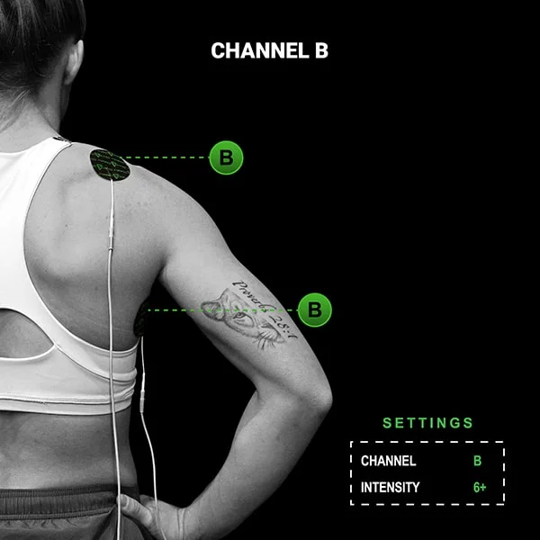 Channel B placement, one pad near the trap and one on the serratus anterior