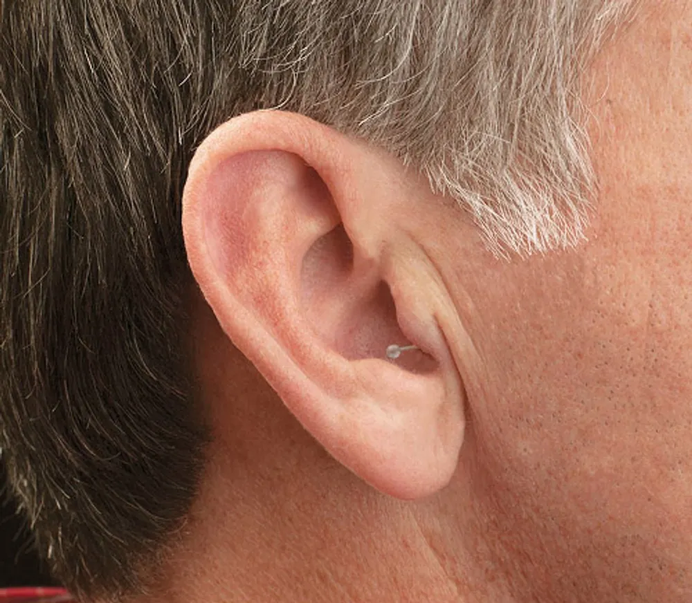 Close-up of a man's ear with an MDHearing NEO XS in-the-canal hearing aid barely visible inside the ear canal