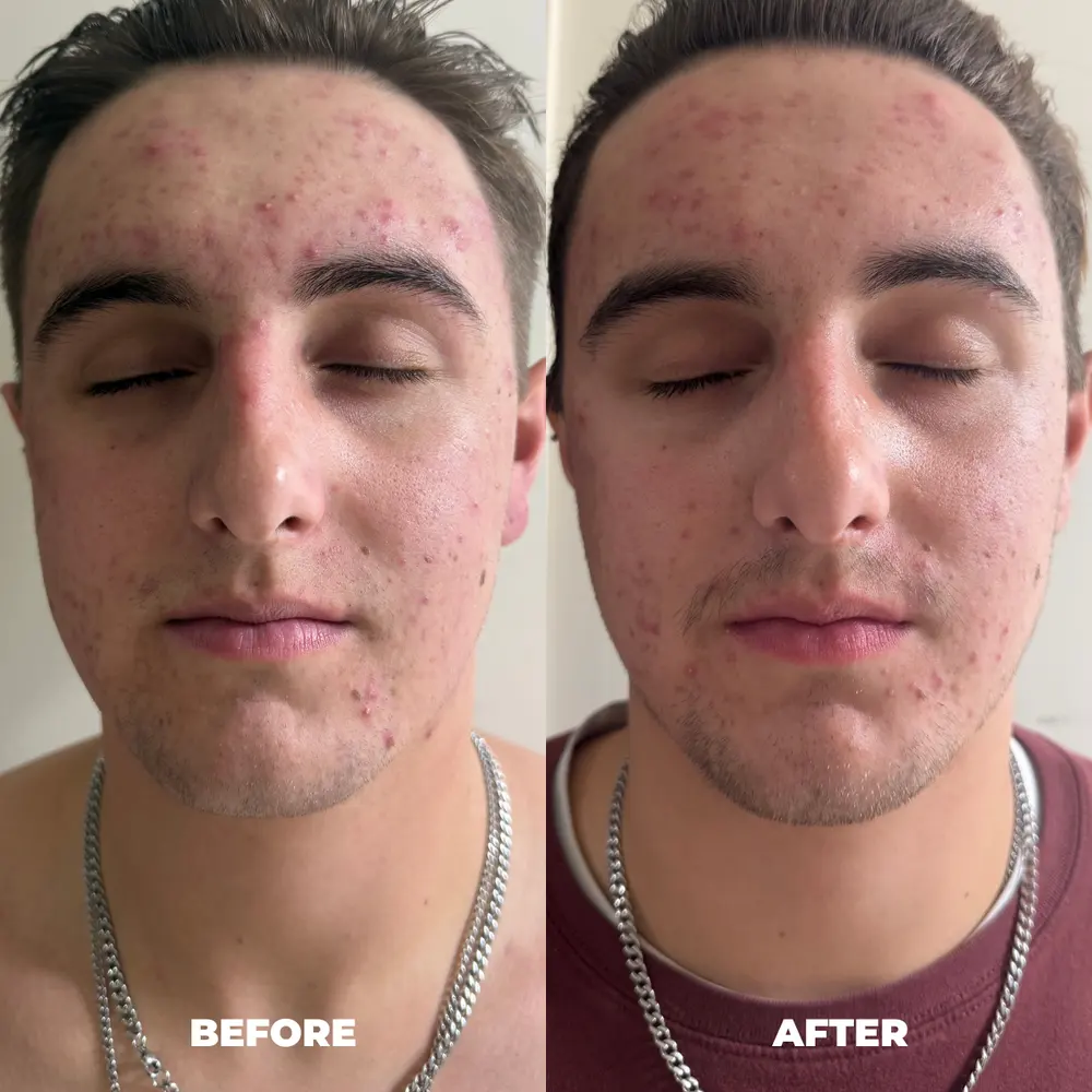 Customer before and after photos at four weeks, Wes M.