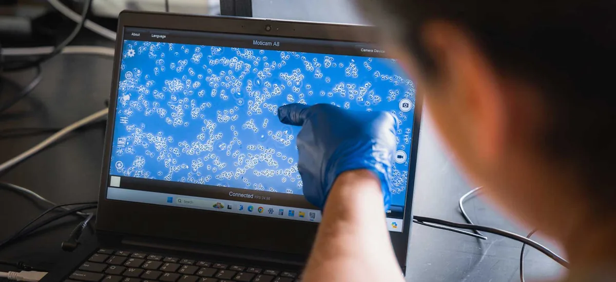 A ZBiotics scientist examining engineered Bacillus subtilis cells on a laptop-connected microscope display